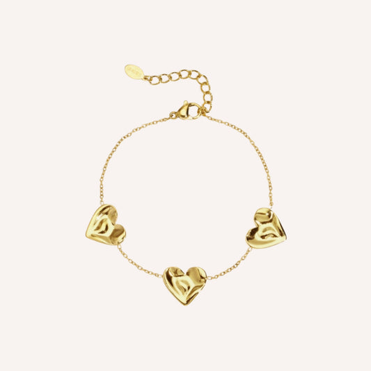 Elba Armband